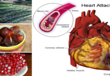 Meet The 5 Best Allies Against Heart Attack And Heart Diseases