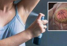 90% of breast cancer could likely be prevented if everyone did some of these 12 things