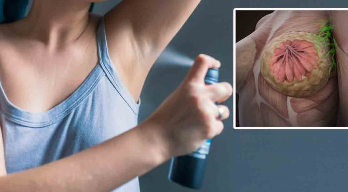 90% of breast cancer could likely be prevented if everyone did some of these 12 things
