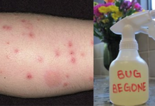 How to Make Homemade Mosquito Repellent That Works