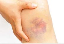 20 Warning Signs of Cancer Too Many Women Ignore