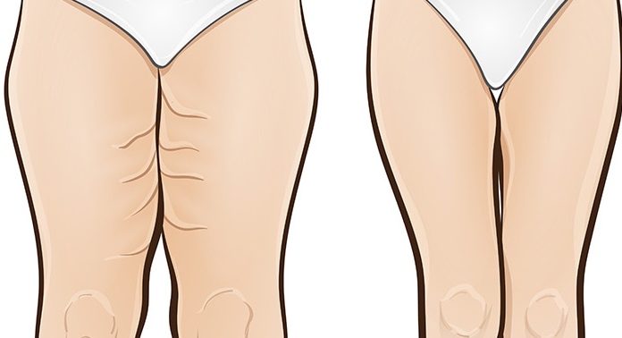 Five Effective Exercises For Slimmer Thighs In Only One Week