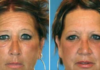 What? Smoker Vs. Non-Smoker Identical Twins Look Like After Years of Smoking