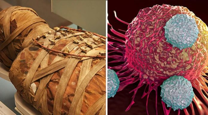 Cancer is a Purely “Man-Made Disease,” British Researchers Suggest After Examining Egyptian Mummies